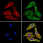 Phospho-Vinculin (Tyr822) Polyclonal Antibody