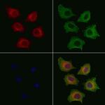 Phospho-PLCG1 (Tyr771) Polyclonal Antibody