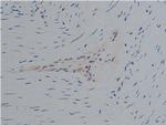Phospho-PLCG1 (Tyr771) Antibody in Immunohistochemistry (Paraffin) (IHC (P))
