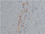 Phospho-PLCG1 (Tyr771) Antibody in Immunohistochemistry (Paraffin) (IHC (P))