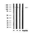 Phospho-PLCG1 (Tyr771) Antibody in Western Blot (WB)