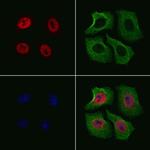 Phospho-Elk1 (Ser383) Polyclonal Antibody