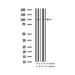 Phospho-NFkB p105/p50 (Ser932) Polyclonal Antibody