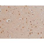 Phospho-Filamin A (Ser2152) Antibody in Immunohistochemistry (Paraffin) (IHC (P))