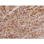 Phospho-Filamin A (Ser2152) Antibody in Immunohistochemistry (Paraffin) (IHC (P))