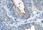 Phospho-Synaptotagmin 1/2 (Ser309) Polyclonal Antibody