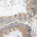 Phospho-c-Cbl (Tyr674) Polyclonal Antibody