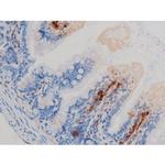 Phospho-p70 S6 Kinase (Ser371) Polyclonal Antibody