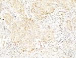 Phospho-p70 S6 Kinase (Thr389, Thr412) Antibody in Immunohistochemistry (Paraffin) (IHC (P))