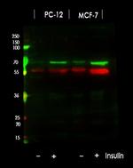 Phospho-p70 S6 Kinase (Thr389, Thr412) Antibody in Western Blot (WB)
