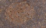 Phospho-p70 S6 Kinase (Thr444) Antibody in Immunohistochemistry (Paraffin) (IHC (P))