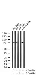 Phospho-p70 S6 Kinase (Thr444) Antibody in Western Blot (WB)