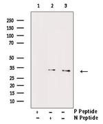 Phospho-Cyclin D1 (Ser90) Antibody in Western Blot (WB)