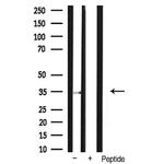 Phospho-Cyclin D1 (Ser90) Antibody in Western Blot (WB)