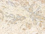 Phospho-CDK2 (Thr160) Antibody in Immunohistochemistry (Paraffin) (IHC (P))