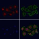 Phospho-CDK2 (Thr160) Polyclonal Antibody