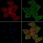 Phospho-PI3K p85 alpha (Tyr607) Polyclonal Antibody