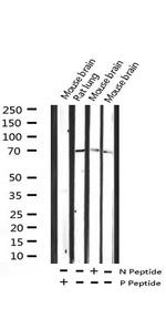 Phospho-Shc (Tyr427) Antibody in Western Blot (WB)