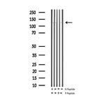 Phospho-eNOS (Thr495) Polyclonal Antibody