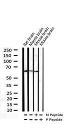 Phospho-CDC25B (Ser323) Antibody in Western Blot (WB)