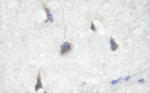 Phospho-Cdc25B (Ser353) Antibody in Immunohistochemistry (Paraffin) (IHC (P))