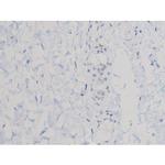 Phospho-AKT1 (Thr450) Polyclonal Antibody