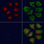 Phospho-AKT1 (Ser124) Polyclonal Antibody