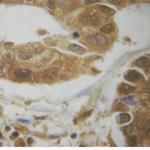 Phospho-AKT1 (Ser124) Antibody in Immunohistochemistry (Paraffin) (IHC (P))