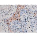 Phospho-AKT1 (Ser124) Antibody in Immunohistochemistry (Paraffin) (IHC (P))