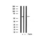 Phospho-AKT1 (Ser124) Antibody in Western Blot (WB)