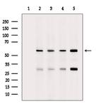 Phospho-beta Catenin (Ser33) Antibody in Western Blot (WB)