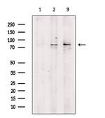 Phospho-beta Catenin (Ser33) Antibody in Western Blot (WB)