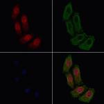 Phospho-beta Catenin (Ser33) Polyclonal Antibody