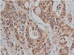Phospho-beta Catenin (Ser33) Antibody in Immunohistochemistry (Paraffin) (IHC (P))