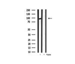 Phospho-beta Catenin (Ser33) Antibody in Western Blot (WB)
