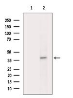 Phospho-beta Catenin (Thr41, Ser45) Antibody in Western Blot (WB)