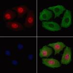 Phospho-beta Catenin (Thr41, Ser45) Antibody in Immunocytochemistry (ICC/IF)