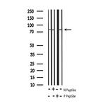 Phospho-beta Catenin (Tyr489) Antibody in Western Blot (WB)