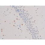 Phospho-IRS1 (Ser636) Antibody in Immunohistochemistry (Paraffin) (IHC (P))