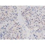 Phospho-alpha Adducin (Ser726) Antibody in Immunohistochemistry (Paraffin) (IHC (P))