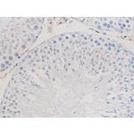Phospho-alpha Adducin (Ser726) Antibody in Immunohistochemistry (Paraffin) (IHC (P))
