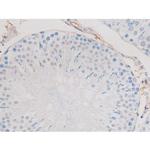 Phospho-alpha Adducin (Ser726) Antibody in Immunohistochemistry (Paraffin) (IHC (P))