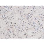 Phospho-alpha Adducin (Ser726) Antibody in Immunohistochemistry (Paraffin) (IHC (P))