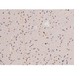 Phospho-alpha Adducin (Ser726) Antibody in Immunohistochemistry (Paraffin) (IHC (P))