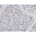 Phospho-alpha Adducin (Ser726) Antibody in Immunohistochemistry (Paraffin) (IHC (P))