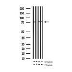 Phospho-alpha Adducin (Ser726) Antibody in Western Blot (WB)