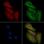 Phospho-MEK2 (Thr394) Polyclonal Antibody