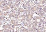 Phospho-MEK2 (Thr394) Antibody in Immunohistochemistry (Paraffin) (IHC (P))