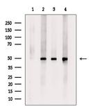 Phospho-MEK2 (Thr394) Antibody in Western Blot (WB)