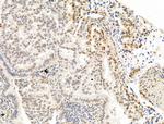 Phospho-PPAR gamma (Ser112) Antibody in Immunohistochemistry (Paraffin) (IHC (P))
